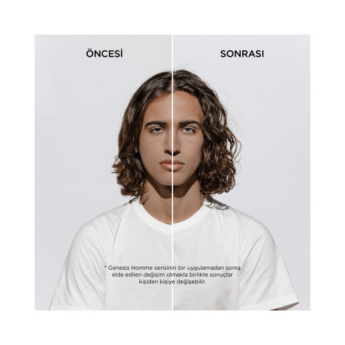 Saç Dökülme Karşıtı Güçlendirici Serum 90ml Saç Dökülme Karşıtı Güçlendirici Serum 90ml